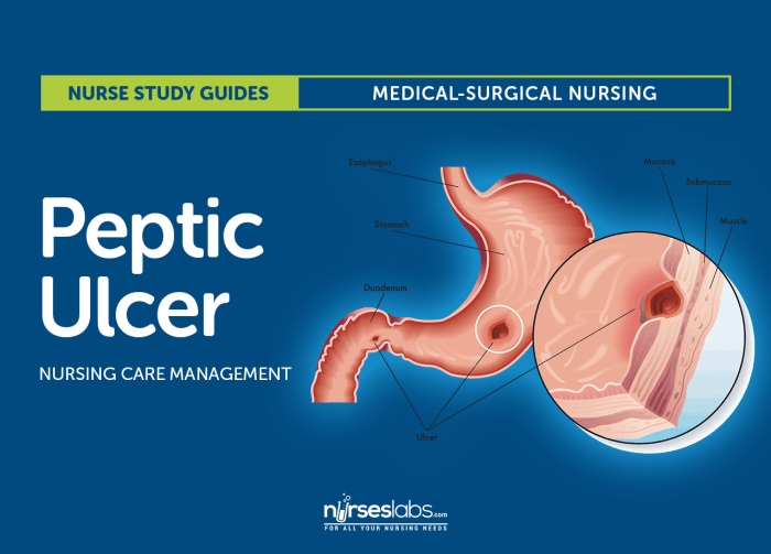 Hesi case study peptic ulcer disease