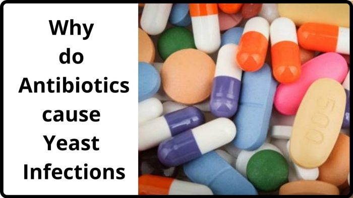 Antibiotics infection yeast why healthandfitnessadviser